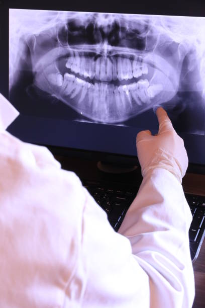 Best Knocked-Out Tooth (Avulsed Tooth) Treatment in Las Animas, CO